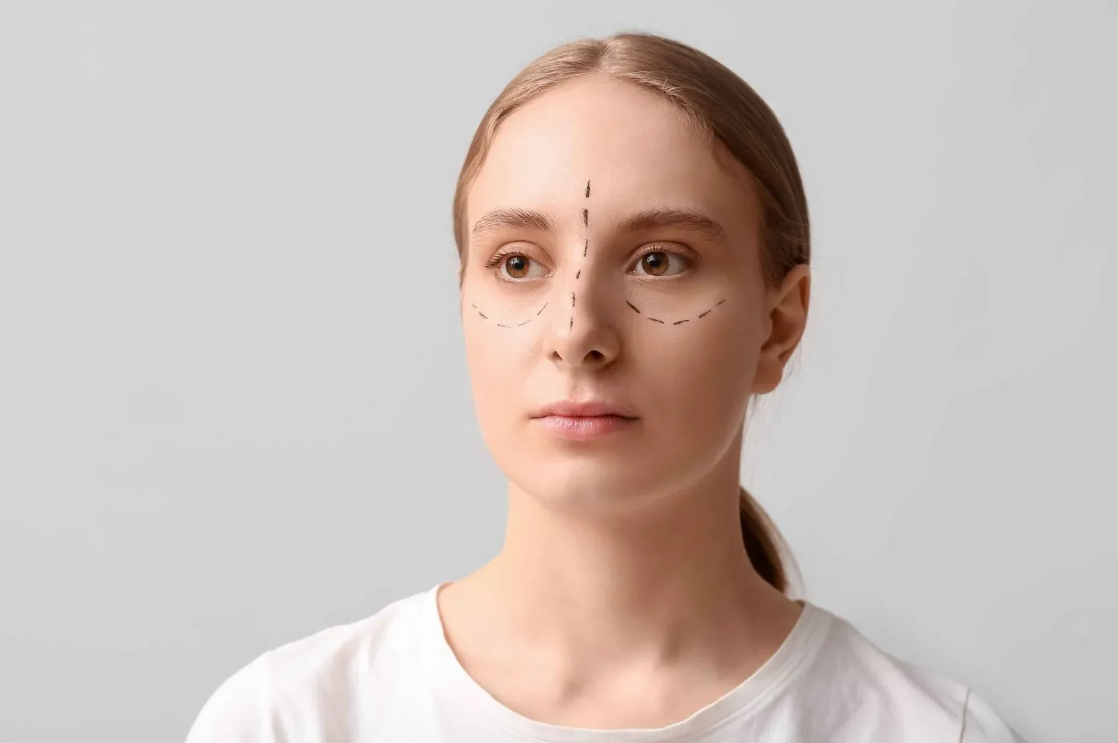 Do and Don’ts Before and Post Blepharoplasty Procedure